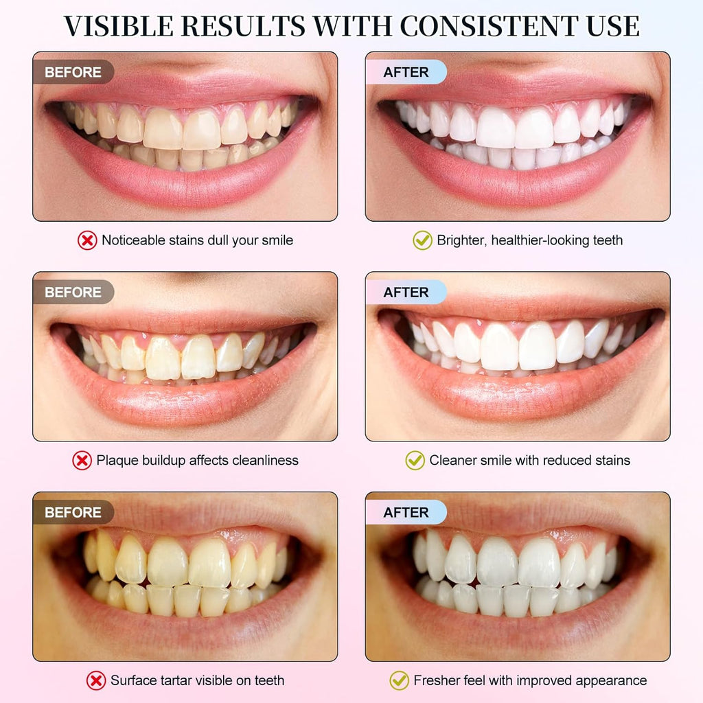 Nicotinamide White Toothpaste