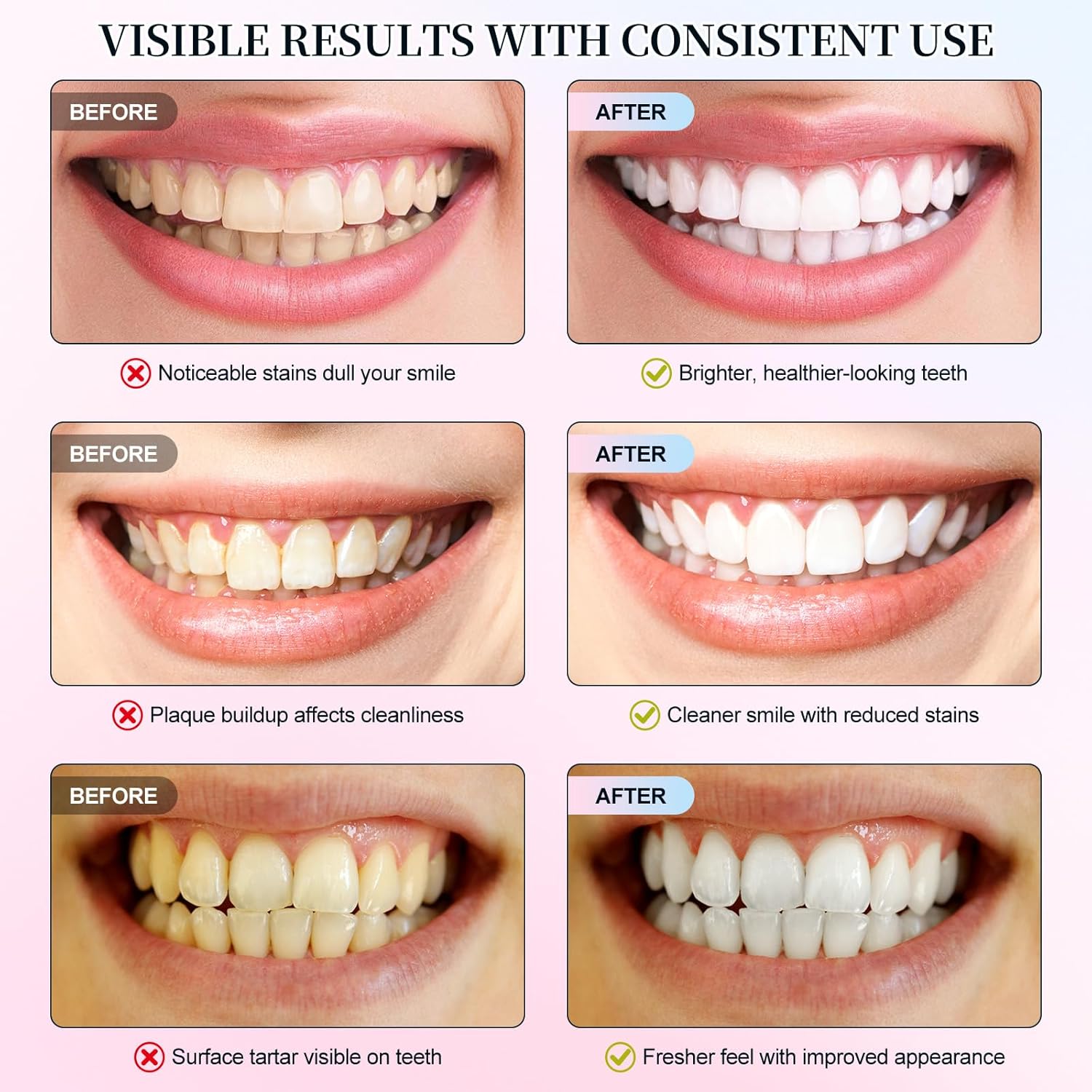 Nicotinamide White Toothpaste