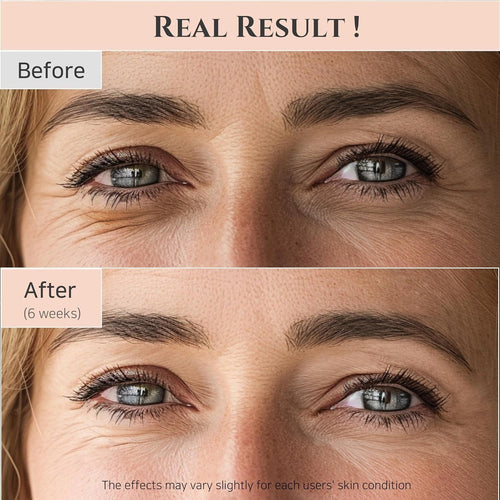 Beauty of Joseon Revive Eye Serum Awaken Your Eyes with Timeless Elegance